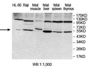 KDELC1 Antibody (aa326-494)