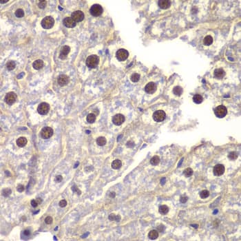 ST14 / Matriptase Antibody (aa566-855)