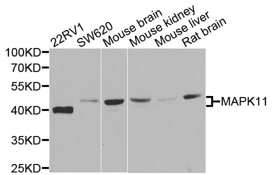MAPK11 / SAPK2 / p38 Beta Antibody (AP)