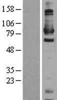 DAXX Protein (Over-Expression Lysate Myc-DDK (Flag))
