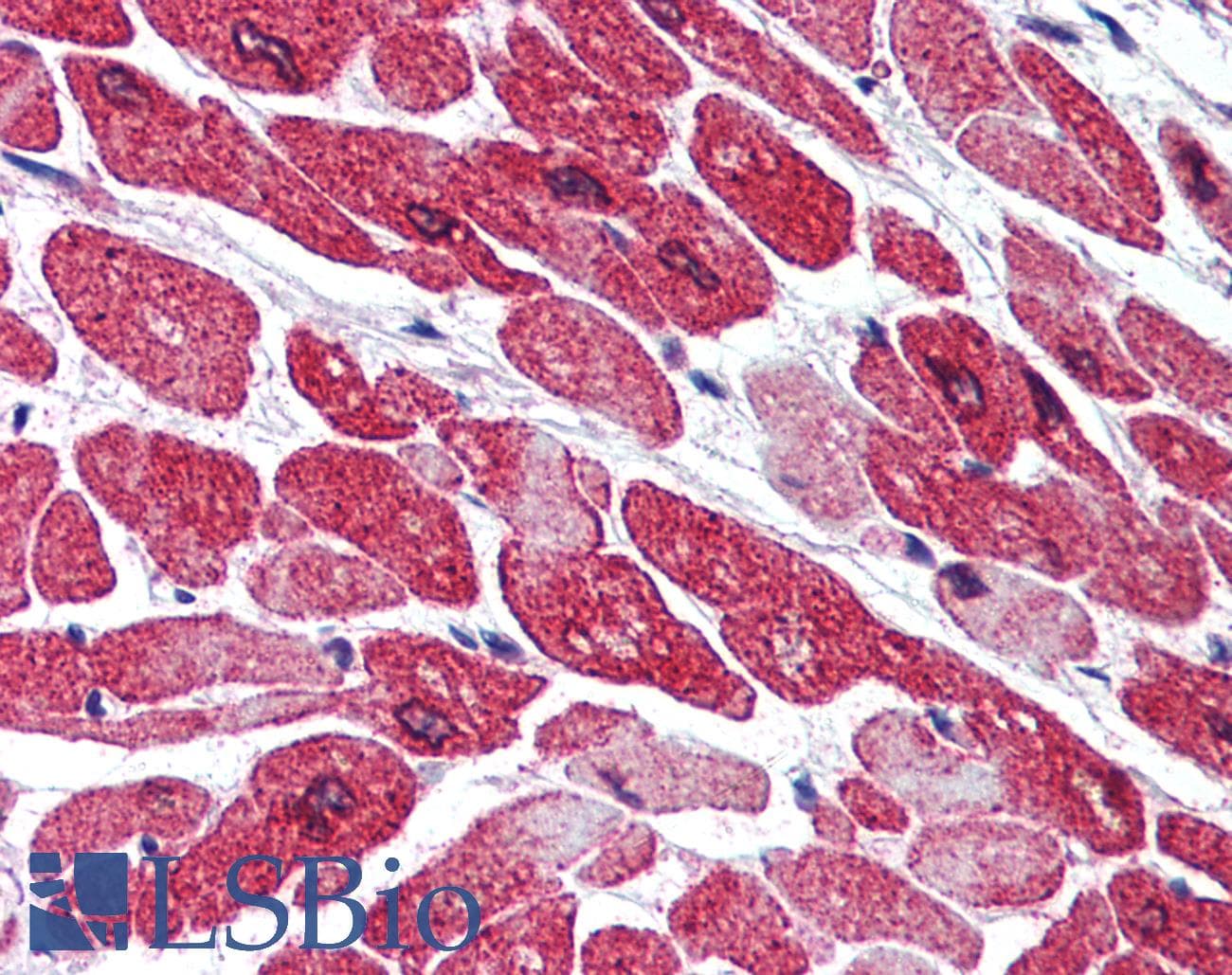 IHC-plus™ KDM1A / LSD1 Antibody (aa100-150)
