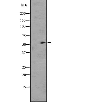 Polyclonal Rabbit anti-Human GPR162 Antibody (WB)