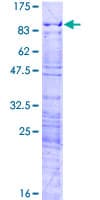 Human HP1BP3 Protein (Recombinant GST)