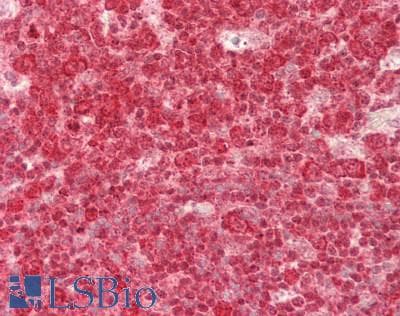KLRK1 / CD314 / NKG2D Antibody (C-Terminus)