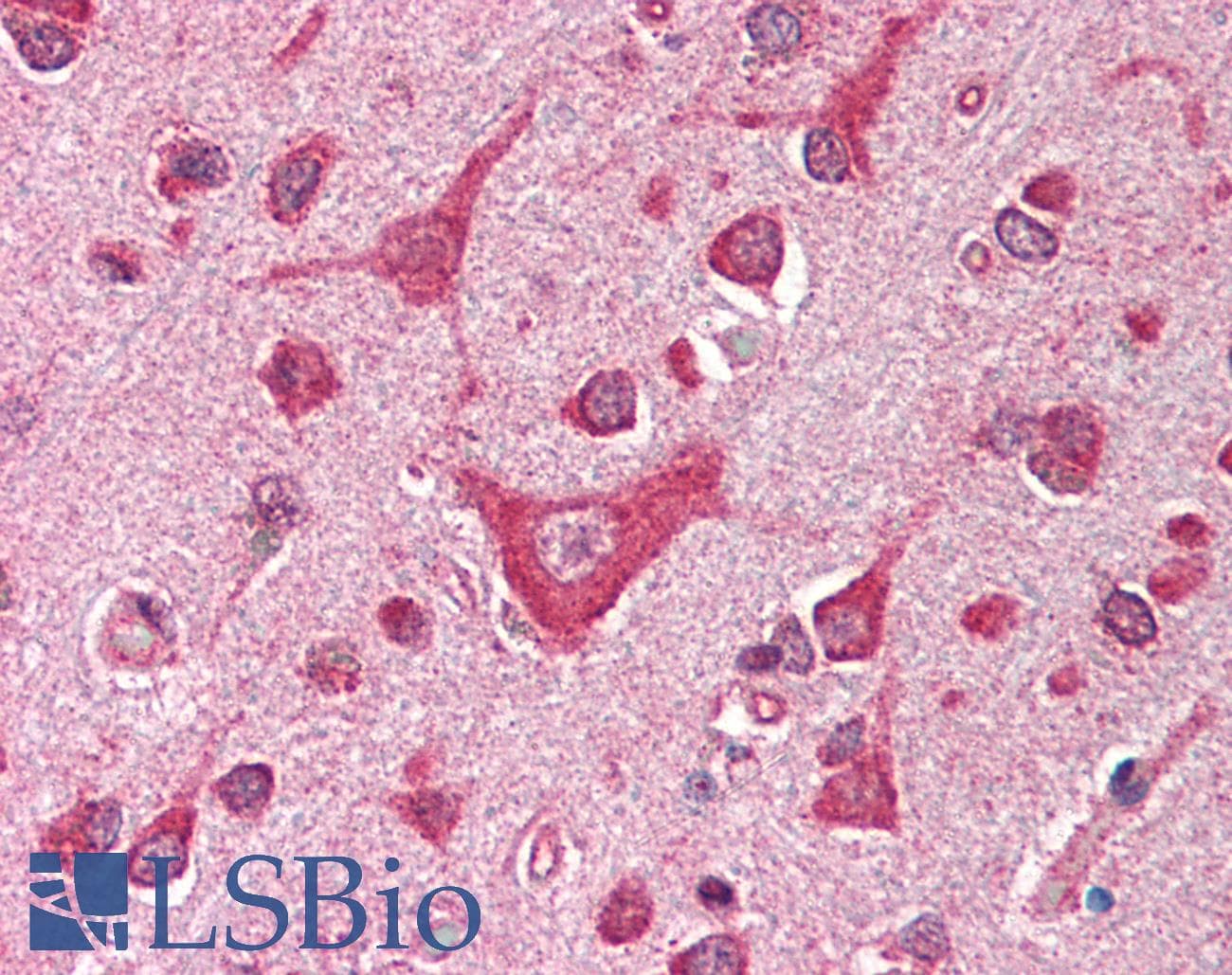 IHC-plus™ CAMK4 / CaMK IV Antibody