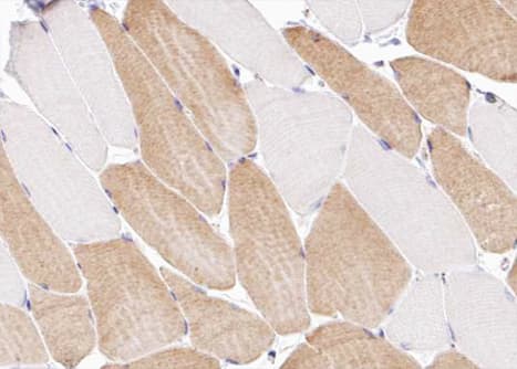 Collagen XII Alpha 1 Antibody