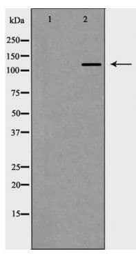 Polyclonal Rabbit anti-Human HDAC6 Antibody (IHC, WB)
