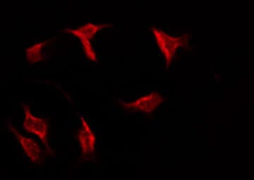 NCAM2 Antibody