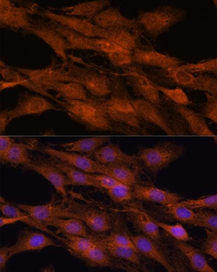 COMMD5 Antibody