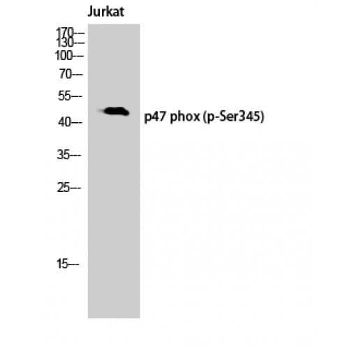 NCF1 / p47phox / p47 phox Antibody (280-360 aa)