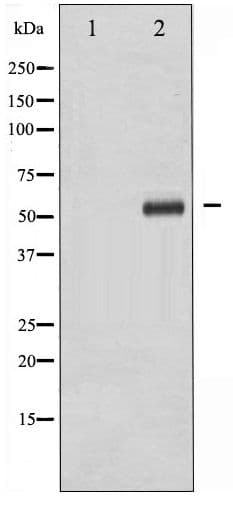 DOK2 Antibody (phospho-Tyr299)