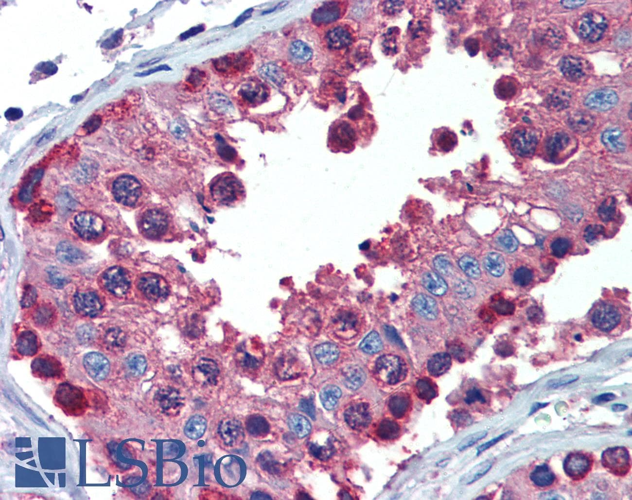 IHC-plus™ PDIA4 / ERP72 Antibody (aa623-638)