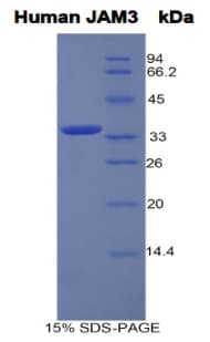 Human JAM3 Protein (Recombinant His-GST, N-terminus)