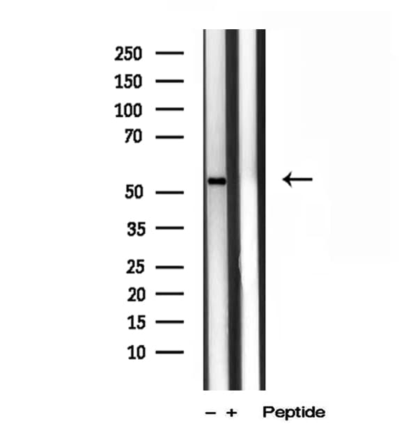 Polyclonal Rabbit anti-Human TMPRSS4 Antibody (IHC, IF, WB)