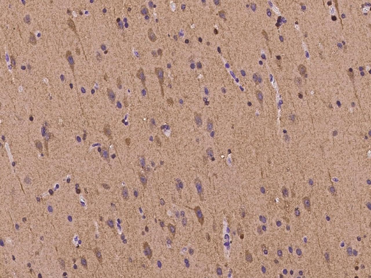 MAPRE2 / EB2 Antibody