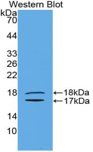 INHBE / Activin Antibody (aa237-350)