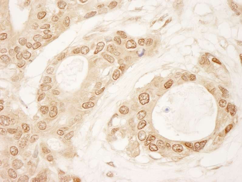 Polyclonal Rabbit anti-Human SDE2 / C1orf55 Antibody (aa350-400, IHC)