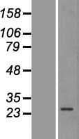 PRKAB2 / AMPK Beta 2 Protein (Over-Expression Lysate Myc-DDK (Flag))