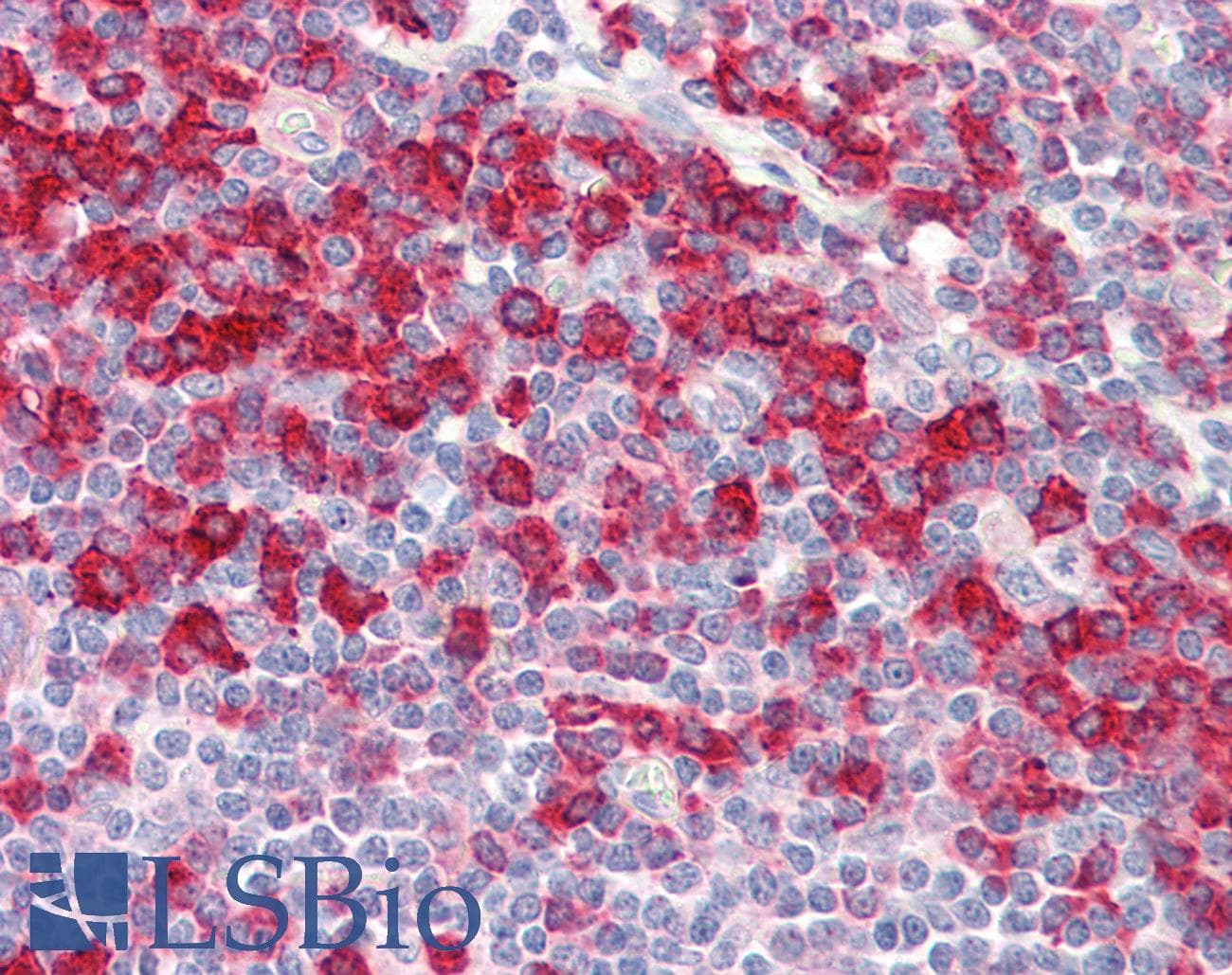 IHC-plus™ Polyclonal Rabbit anti-Human D52 / TPD52 Antibody (aa41-90, IHC)