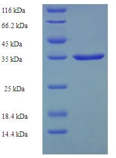 Human PCA1 / ALKBH3 Protein (Recombinant His-SUMO)