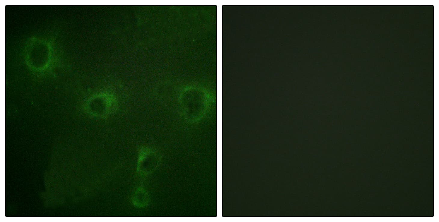Polyclonal Rabbit anti-Human KCNB1 / Kv2.1 Antibody (aa533-582, IHC, IF)