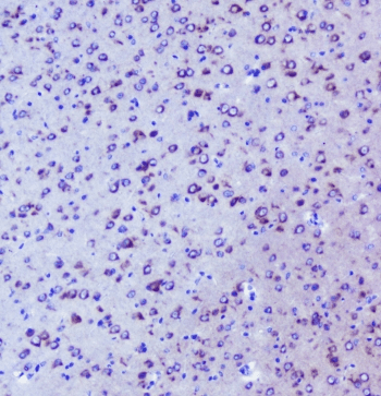 Polyclonal Rabbit anti-Mouse IGF2R / CD222 Antibody (IHC, WB)