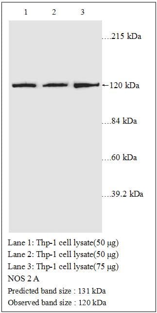 Polyclonal Rabbit anti-Human NOS2 / iNOS Antibody (WB)