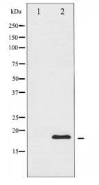 DDIT3 / CHOP Antibody