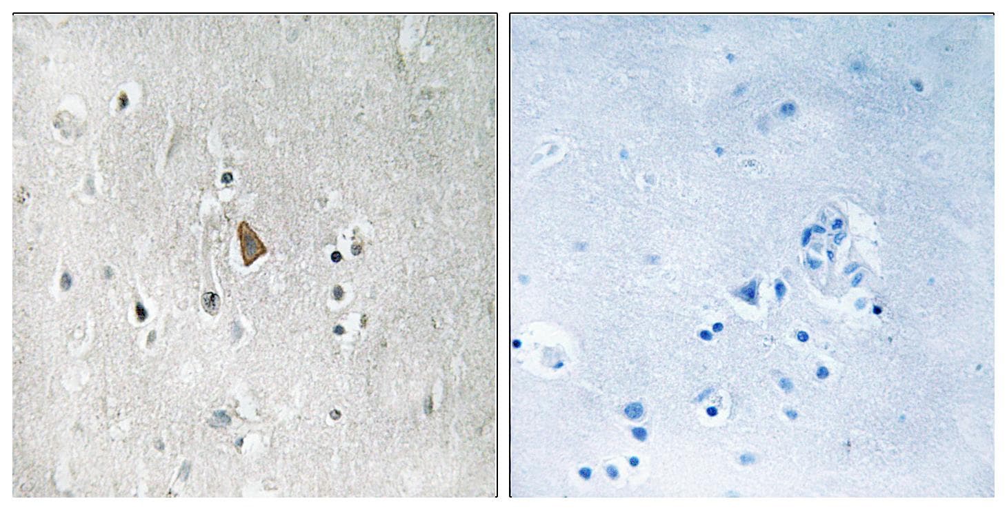 Polyclonal Rabbit anti-Human IGF1R / IGF1 Receptor Antibody (phospho-Tyr1346, IHC)