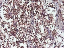 DSTN / Destrin Antibody (clone OTI1G8, Carrier-free)