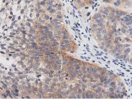 PRKD2 / PKD2 Antibody (clone OTI4F1)