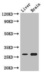 Polyclonal Rabbit anti-Human CO-029 / TSPAN8 Antibody