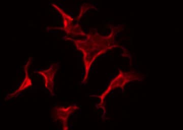 Polyclonal Rabbit anti-Human ESR2 / ER Beta Antibody (phospho-Ser105, IF, WB)