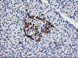 Monoclonal Mouse anti-Human ACSS2 / ACAS2 Antibody (clone OTI3H4, IHC, WB)