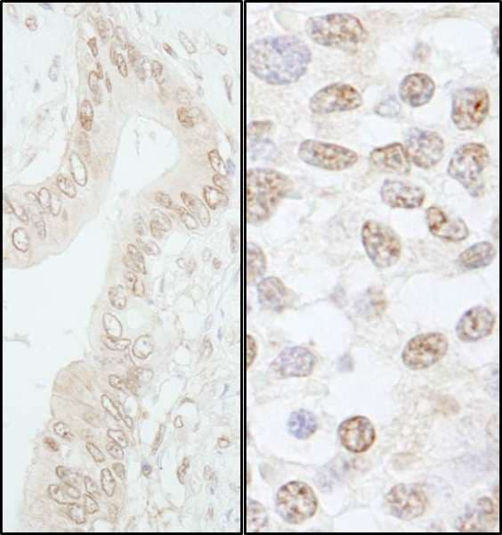 POLL / DNA Polymerase Lambda Antibody (aa525-575)