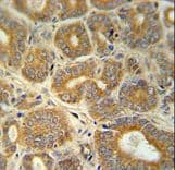 Polyclonal Rabbit anti-Human CRABP1 / CRABP Antibody (aa90-118, IHC, WB)