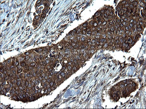 Monoclonal Mouse anti-Human PDCD6IP / ALIX Antibody (clone OTI1A4, IHC, WB)