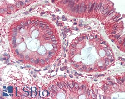 Polyclonal Rabbit anti-Human KALRN / KALIRIN Antibody (Internal, IHC, IF, WB)