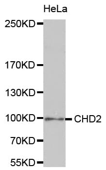 CHD2 Antibody