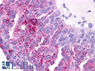 PathPlus™ Polyclonal Rabbit anti-Human PTGER3 / EP3 Antibody (N-Terminus, IHC)