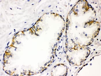 Polyclonal Rabbit anti-Human CD46 Antibody (IHC, WB)