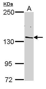 Polyclonal Rabbit anti-Human POLR2B / RPB2 Antibody (aa1-172, IHC, WB)