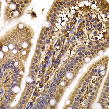 CLASP1 Antibody