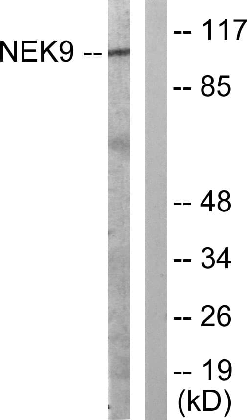 NEK9 Antibody (aa176-225)