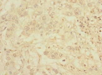 C1orf127 Antibody