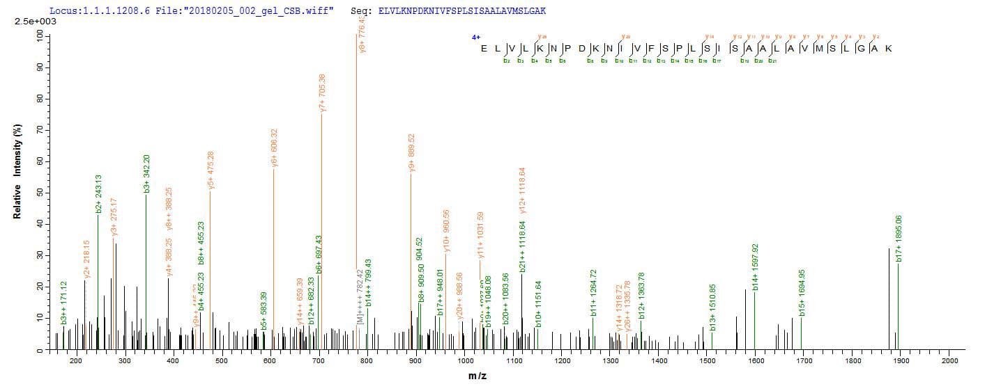 Mouse Serpina3n Protein (Recombinant 6His-SUMO, N-terminus)