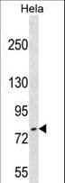 FASTKD3 Antibody (aa623-650)