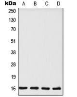 TSC22D1 / TSC22 Antibody (C-Terminus)