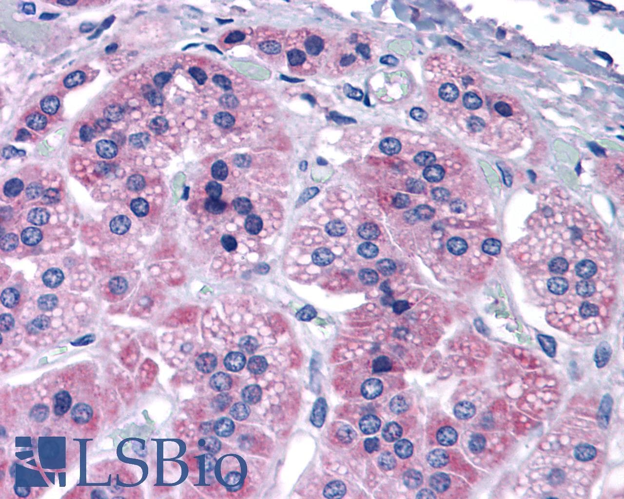 PathPlus™ Polyclonal Rabbit anti-Human GRM7 / MGLUR7 Antibody (N-Terminus, IHC, WB)