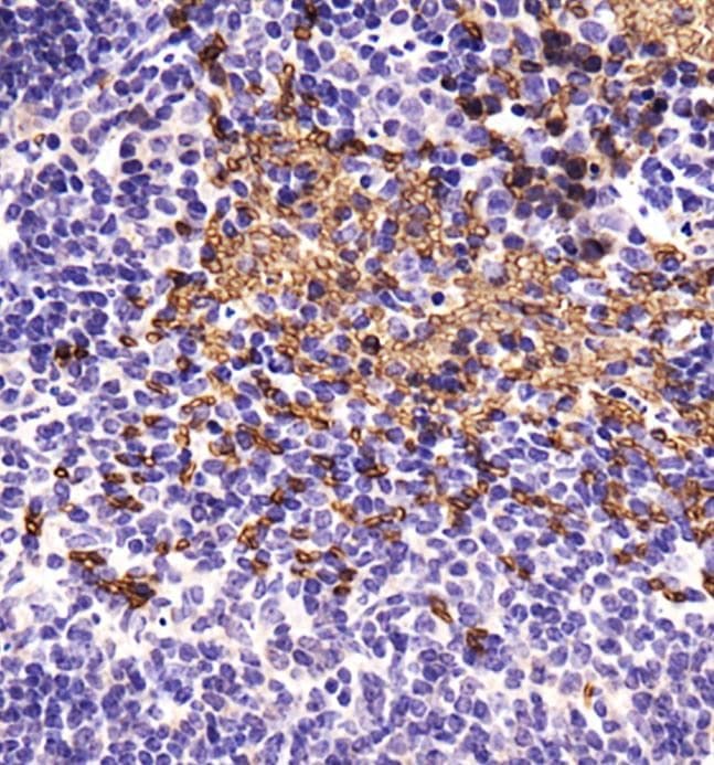ABCB5 Antibody (Biotin)